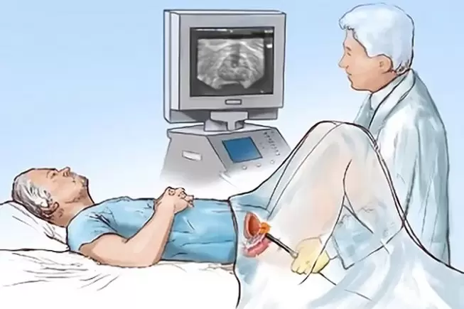 diagnostika prostatitídy